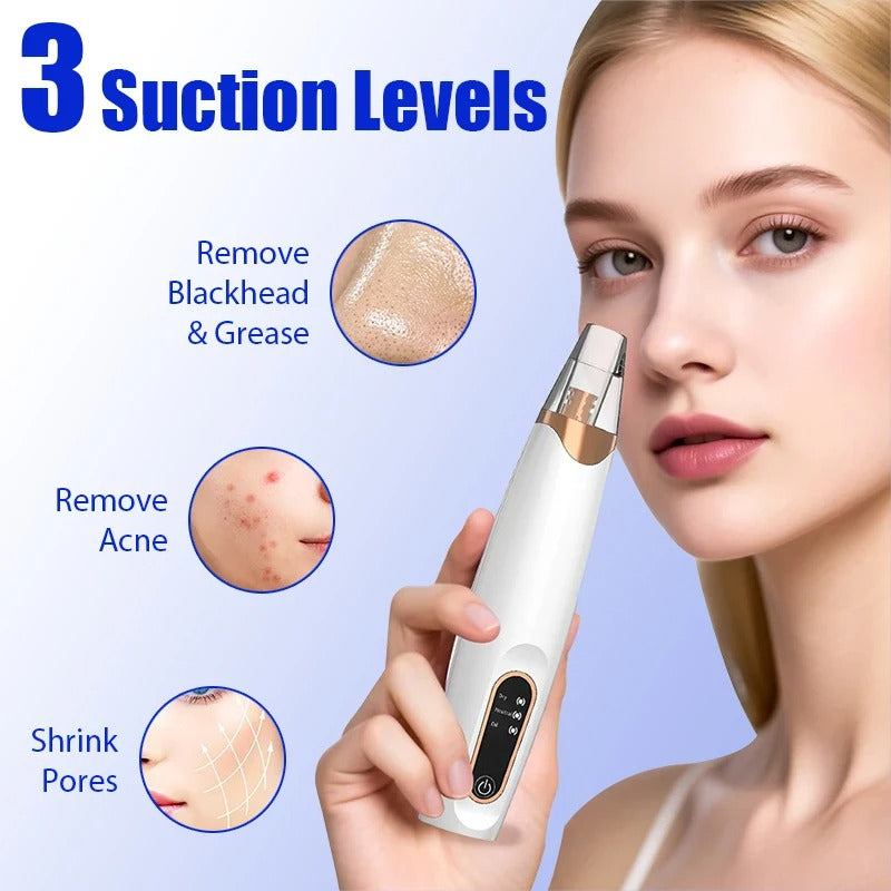 Vacuum Nose Blackhead Remover