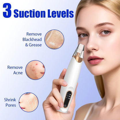 Vacuum Nose Blackhead Remover